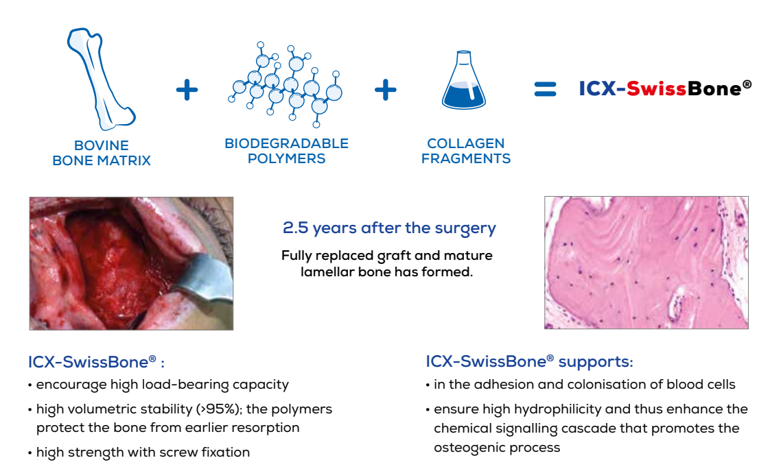 ICX-P5 Intraoral Scanner